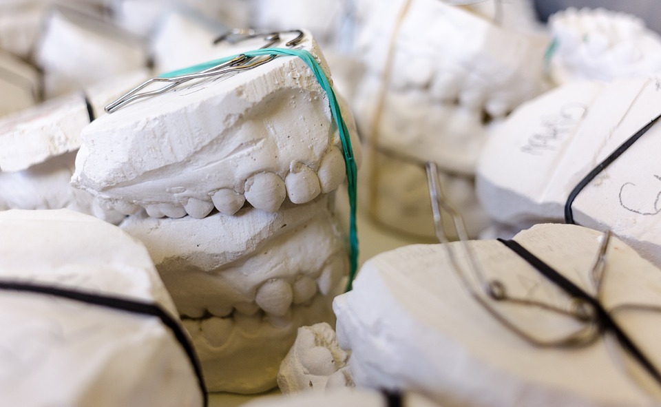 implant dentar implant dentar Cum iti coloreaza viata un implant dentar implant dentar